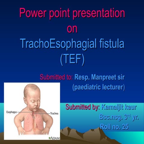 TRACHEOESOPHAGEAL FISTULA | PPTX
