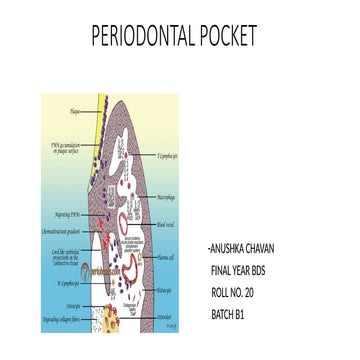 Comprehensive Overview of Periodontal Pockets: Definition ...