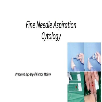 Fine needle aspiration and cytology | PPT