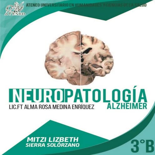 Fisiopatología ALZHEIMER