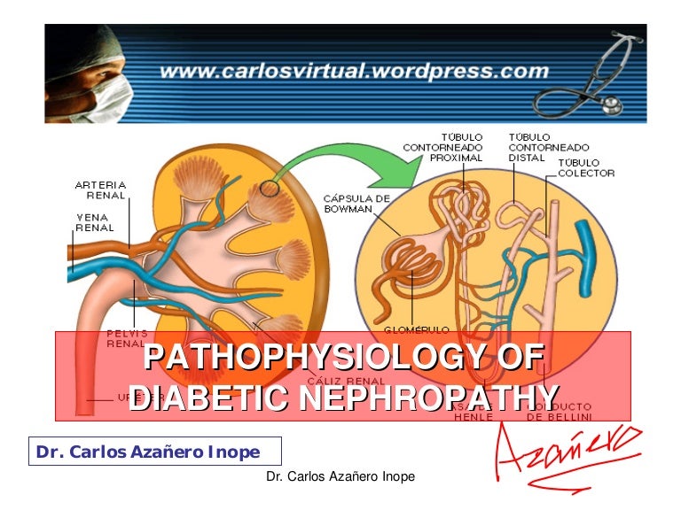 nefropatia diabetica pdf kezelés a 2. típusú diabétesz fokhagyma