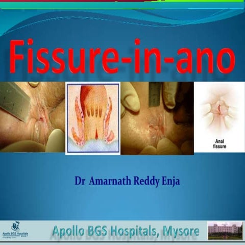 Fissure in-ano- Dr. Enja Amarnath Reddy