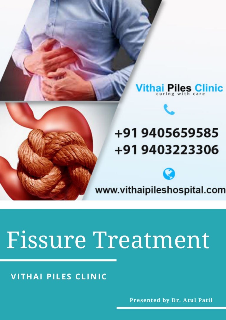 Fissure Treatment In Pune Vithai Piles Clinic
