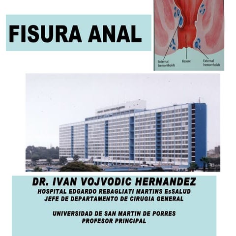 Fisura Anal