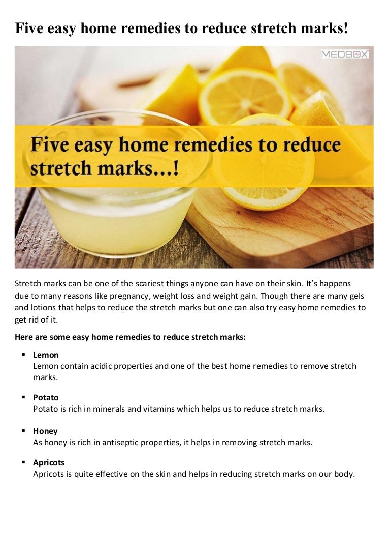 Five Easy Home Remedies To Reduce Stretch Marks