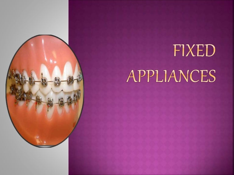 Fixed appliances