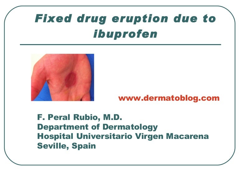 Fixed drug eruption