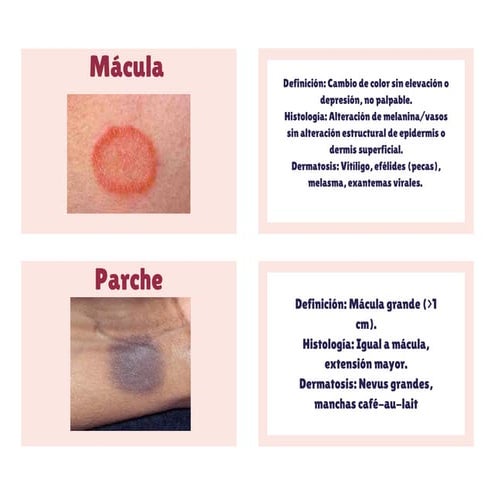 Comprehensive Dermatological Lesion Classification and Histology Guide ...