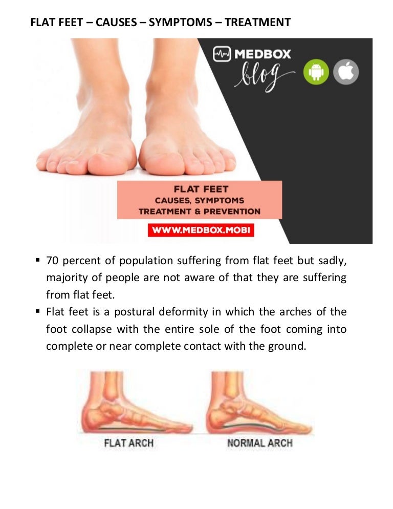 Flat feet causes symptoms treatment