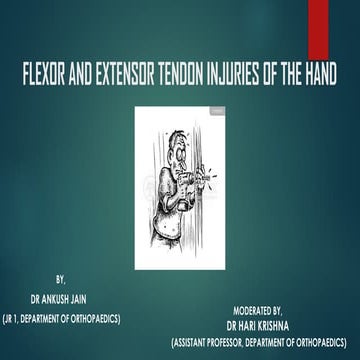 The zones of the hand flexor refer to anatomical areas of the hand ...
