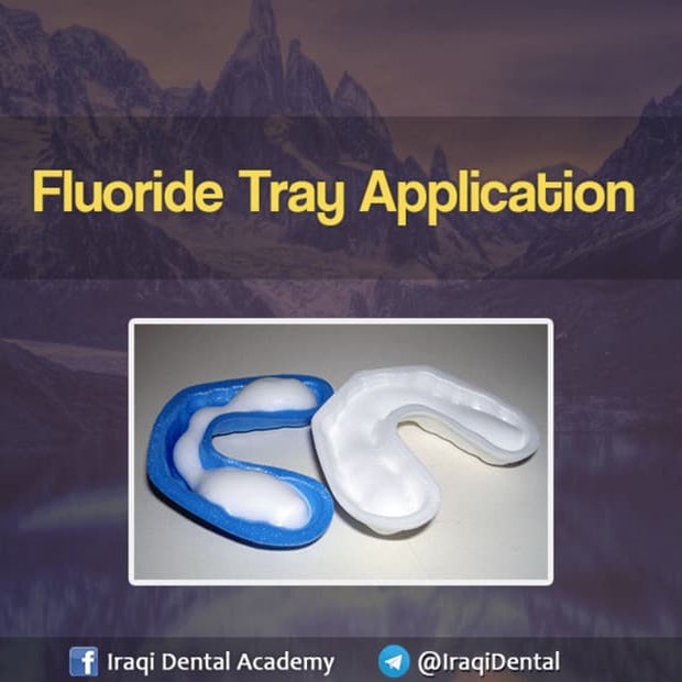 Fluoride Tray Application | PDF