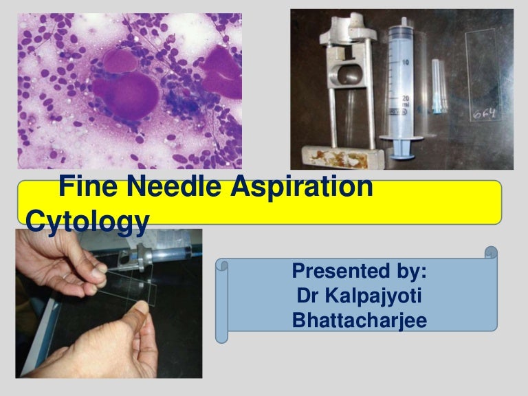 FINE NEEDLE ASPIRATION CYTOLOGY / FNAC
