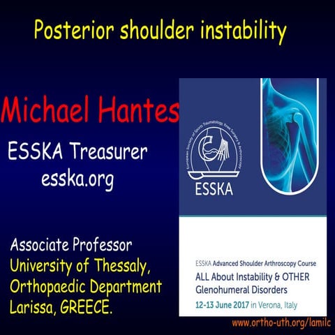 Posterior instability