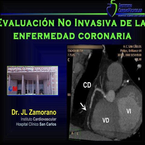Dr. Jose Luis Zamorano. Evolución no invasiva de la enfermedad aterosclerótica