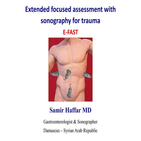 Extended focus assessment with sonography for trauma
