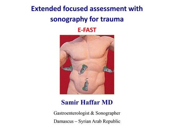 E-Fast Examination | PPT