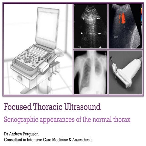 Focused thoracic ultrasound
