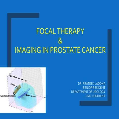 Focussed therapy and imaging in prostate cancer