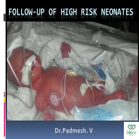 Follow up of High Risk Neonates.. Dr.Padmesh 