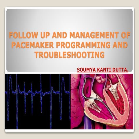 Follow up and management of pacemaker programming and