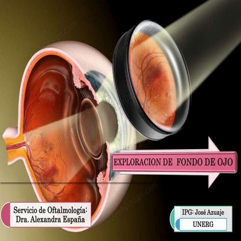 Fondo de ojo_normal_-_dr._jose_miguel_ried | PDF