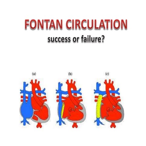 Fontan circulation