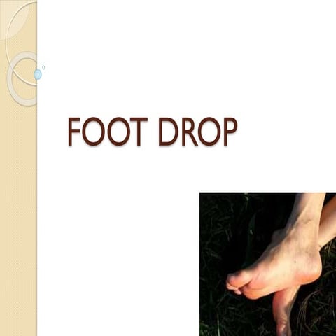 Foot Drop | PPTX