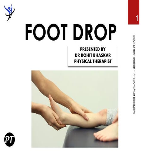 Foot Drop: Causes, Symptoms, and Treatment - Dr Rohit Bhaskar