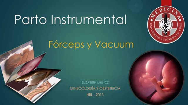 Forcep