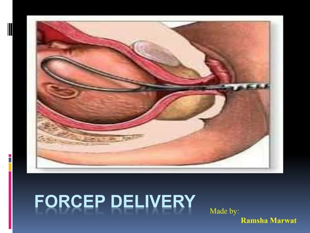Placental anatomy and its functions | PPTX