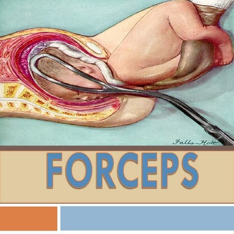 forceps delivery ventouse delivery in gynae | PPT