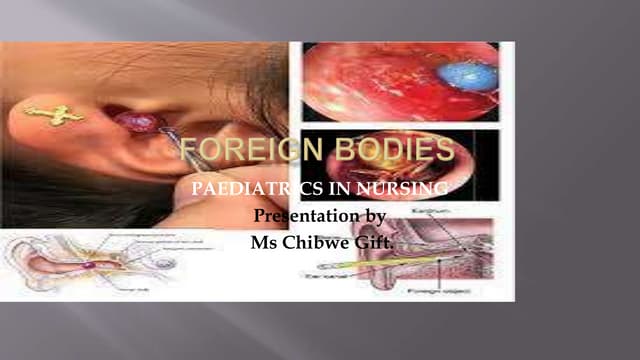 First aid in Foreign bodies Skin, Eye, Ear Nose Throat.pptx