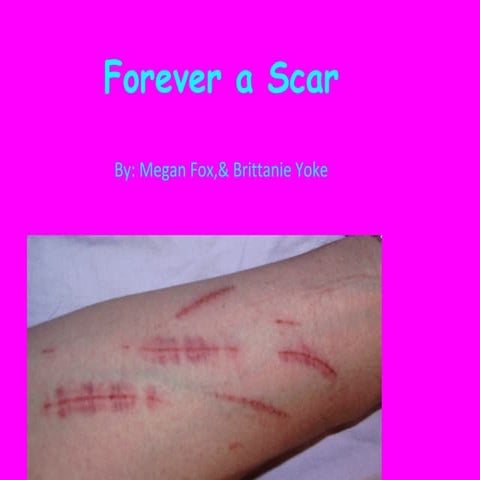 Forever a Scar