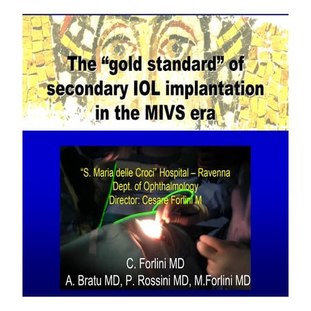 Instruction course-Secondary posterior chamber IOL (PC IOL ...