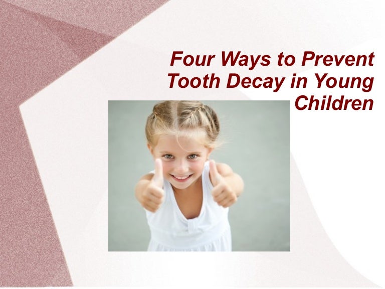 Four Ways to Prevent Tooth Decay in Young Children