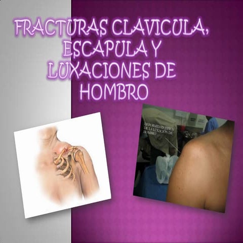 fracturas-de-hombro-pptx
