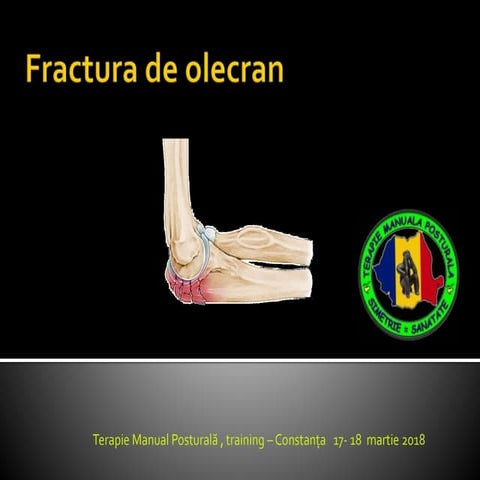 Fractura de olecran  