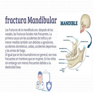 Fractura mandibular | PPTX