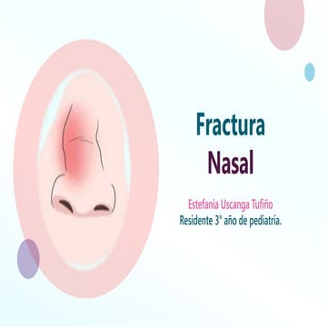 Fractura Nasal.pptx
