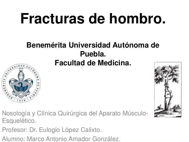hematoma de hennequin