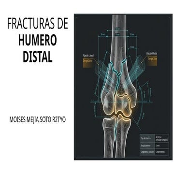 Fracturas de húmero distal ortopedia tyo | PPTX