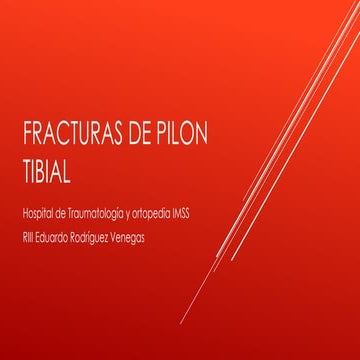 Pilon fractures | PPTX