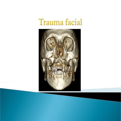 FRACTURAS TRAUMA FACIAL - LE-FORT 2021.ppt