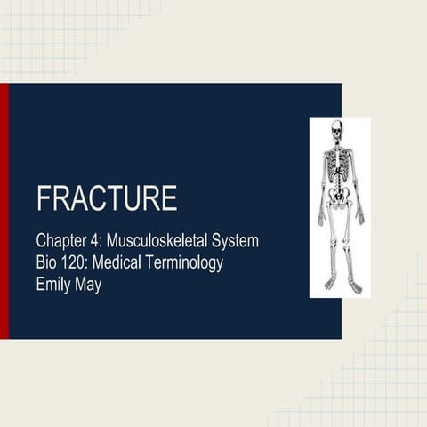 Fracture