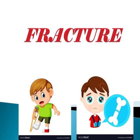 fracture.pdf