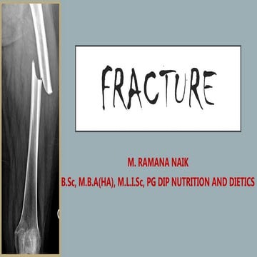 FRACTURE.pptx FIRST AID MANAGEMENT NOTES