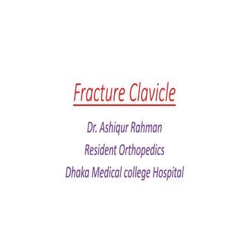 Fracture clavicle