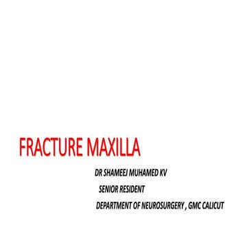 Fracture maxilla