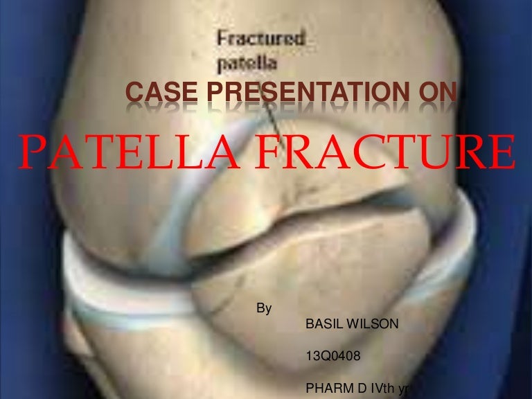 Fracture of patella