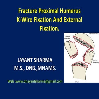 Fracture proximal humerus Fixation ...